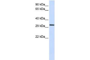 WB Suggested Anti-C21orf2  Antibody Titration: 0. (C21orf2 抗体  (N-Term))