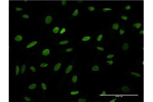Immunofluorescence (IF) image for anti-Acidic (Leucine-Rich) Nuclear phosphoprotein 32 Family, Member B (ANP32B) (AA 1-251) antibody (ABIN948954)