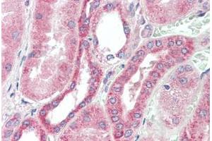 Human Kidney: Formalin-Fixed, Paraffin-Embedded (FFPE) (RDH10 抗体  (AA 71-120))