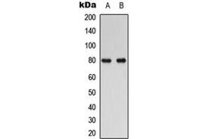 Western blot analysis of RAD17 expression in human Oral cancer (A), HuvEc (B) whole cell lysates. (RAD17 抗体  (C-Term))