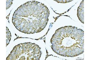 IHC analysis of ACLY using anti-ACLY antibody (ABIN4886416). (ACLY 抗体  (AA 1-180))