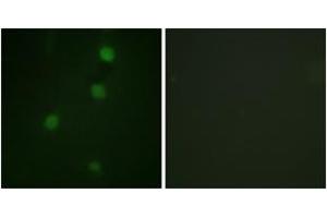 Immunofluorescence analysis of NIH-3T3 cells, using Retinoblastoma (Ab-821) Antibody. (Retinoblastoma Protein (Rb) 抗体  (AA 791-840))