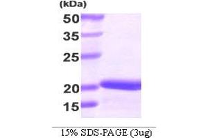 SDS-PAGE (SDS) image for Stathmin 1 (STMN1) (AA 1-149) protein (His tag) (ABIN667094)
