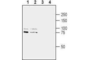 SLITRK1 抗体  (Extracellular, N-Term)
