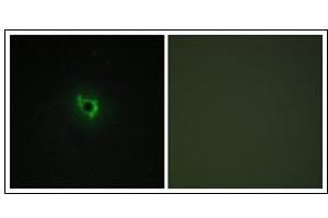 Immunofluorescence analysis of COS7 cells, using EPHA6 Antibody. (EPH Receptor A6 抗体  (C-Term))