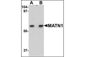 Western blot analysis of MATN1 in rat liver tissue lysate with this product at (A) 1 and (B) 2 μg/ml. (MATN1 抗体  (C-Term))