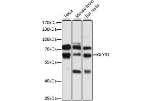 Western blot analysis of extracts of various cell lines, using GLYR1 antibody. (GLYR1 抗体)