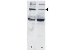 Western Blotting (WB) image for anti-Signal Transducer and Activator of Transcription 3 (Acute-Phase Response Factor) (STAT3) (pSer727) antibody (ABIN3032570)