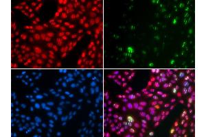 Immunofluorescence analysis of U2OS cells using CUL4B antibody (ABIN6130211, ABIN6139255, ABIN6139258 and ABIN6221048).