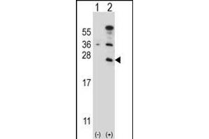 Western blot analysis of CD3E (arrow) using rabbit polyclonal CD3E Antibody (C-term) (ABIN657454 and ABIN2846481). (CD3 epsilon 抗体  (C-Term))