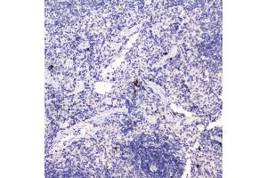 IHC analysis of HE4 using anti-HE4 antibody (ABIN5693137). (WFDC2 抗体  (AA 31-124))
