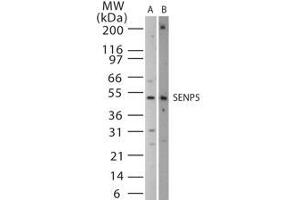 Image no. 1 for anti-SUMO1/sentrin Specific Peptidase 5 (SENP5) (AA 229-246) antibody (ABIN208763) (SENP5 抗体  (AA 229-246))