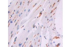 Used in DAB staining on fromalin fixed paraffin- embedded heart tissue (CCRK 抗体  (AA 4-288))
