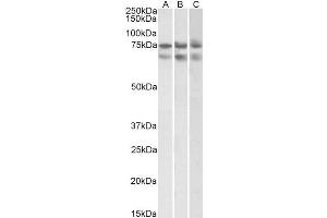 ABIN2613433 (2µg/ml) staining of HeLa (A)HepG2 (B) and K562 (C) nuclear lysates (35µg protein in RIPA buffer). (Nucleostemin 抗体  (Internal Region))