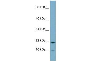 WB Suggested Anti-D15Wsu75e Antibody Titration:  0. (DESI1 抗体  (Middle Region))