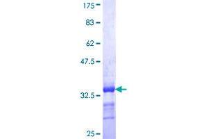 EEA1 Protein (AA 1312-1411) (GST tag)