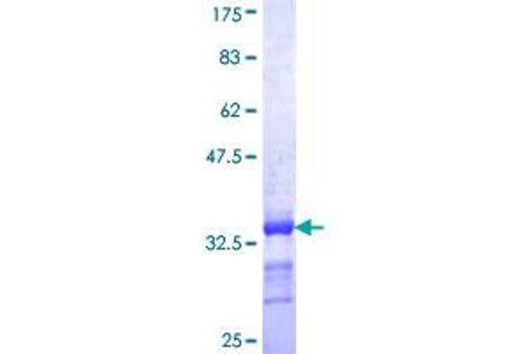 EEA1 Protein (AA 1312-1411) (GST tag)