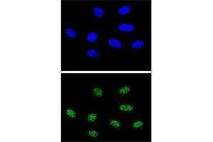 Immunofluorescence (IF) image for anti-Peptidylprolyl Cis/trans Isomerase, NIMA-Interacting 1 (PIN1) (AA 30-56) antibody (ABIN3028920)