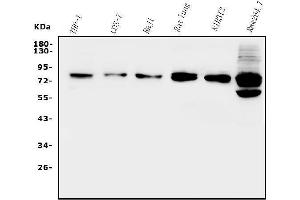 Western blot analysis of GRK2 using anti-GRK2 antibody (ABIN7602826).