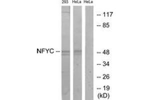 Western Blotting (WB) image for anti-Nuclear Transcription Factor Y, gamma (NFYC) (AA 1-50) antibody (ABIN2890476) (NFYC 抗体  (AA 1-50))