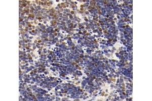 Immunohistochemistry analysis of paraffin-embedded mouse thymus using,MLLT11 (ABIN7074715) at dilution of 1: 4000 (MLLT11 抗体)