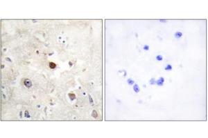 Immunohistochemistry analysis of paraffin-embedded human brain tissue, using p57KIP2 antibody. (CDKN1C 抗体  (N-Term))