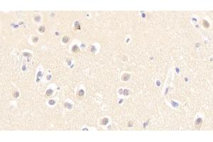 Immunohistochemistry (IHC) image for anti-Neurotrophic tyrosine Kinase, Receptor, Type 3 (NTRK3) (AA 32-429) antibody (ABIN7443641)