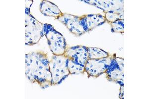 Immunohistochemistry of paraffin-embedded human placenta using Dysferlin (Romeo) Rabbit mAb (ABIN7266868) at dilution of 1:100 (40x lens). (Dysferlin 抗体)
