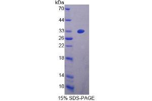 SDS-PAGE analysis of Mouse ZRF1 Protein. (DNAJC2 蛋白)