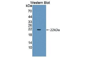 Western blot analysis of the recombinant protein. (SHBG 抗体  (AA 51-218))