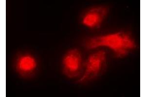 Immunofluorescent analysis of LKB1 staining in A431 cells. (LKB1 抗体  (C-Term))