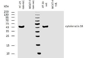 Western blotting analysis of human cytokeratin 18 using mouse monoclonal antibody C-04 on lysates of HT-29 cell line and MOLT-4 cell line (cytokeratin non-expressing cell line, negative control) under non-reducing and reducing conditions. (Cytokeratin 18 抗体)
