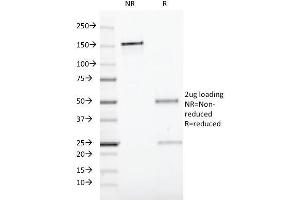 SDS-PAGE (SDS) image for anti-CD19 Molecule (CD19) antibody (ABIN6941099)
