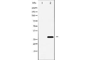Western blot analysis of p27 Kip1 expression in EGF treated HeLa whole cell lysates,The lane on the left is treated with the antigen-specific peptide. (CDKN1B 抗体  (C-Term))