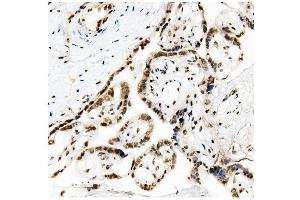 IHC analysis of KAP1/TRIM28 using anti-KAP1/TRIM28 antibody (ABIN7602310). (KAP1 抗体  (AA 699-835))