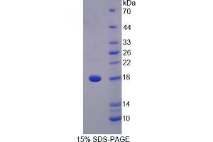 SDS-PAGE analysis of Human STAT5A Protein. (STAT5A 蛋白)