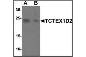 Western blot analysis of TCTEX1D2 in K562 cell lysate with TCTEX1D2at 1 ug/mL in (A) the absence and (B) the presence of blocking peptide.