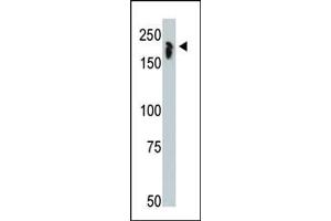 Western Blotting (WB) image for anti-Nuclear Receptor Co-Repressor 1 (NCOR1) (AA 16-47), (N-Term) antibody (ABIN387976)