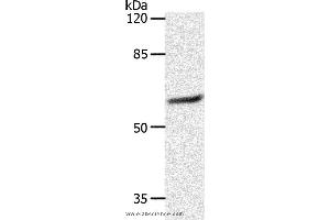 Western blot analysis of 231 cell, using SLC16A4 Polyclonal Antibody at dilution of 1:1200 (SLC16A4 抗体)