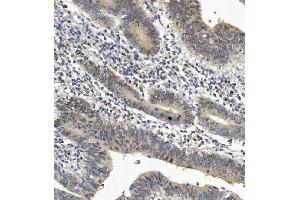 IHC analysis of EYA4 using anti-EYA4 antibody (ABIN7601063). (EYA4 抗体  (AA 28-205))