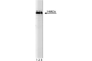 Western Blotting (WB) image for anti-phospholipase C, gamma 1 (PLCG1) (AA 82-100) antibody (ABIN967699) (Phospholipase C gamma 1 抗体  (AA 82-100))