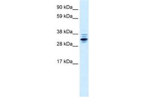 Western Blotting (WB) image for anti-Zinc Finger Protein 654 (ZNF654) antibody (ABIN2460661) (ZNF654 抗体)