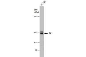 WB Image TIE1 antibody detects TIE1 protein by western blot analysis. (TIE1 抗体)