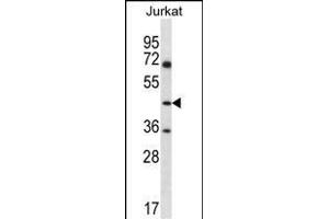 ASS1 Antibody (C-term) (ABIN656537 and ABIN2845801) western blot analysis in Jurkat cell line lysates (35 μg/lane). (ASS1 抗体  (C-Term))