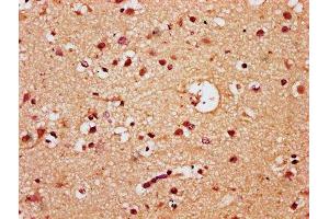 IHC image of ABIN7172459 diluted at 1:300 and staining in paraffin-embedded human brain tissue performed on a Leica BondTM system. (HNF1B 抗体  (AA 539-704))