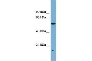 WB Suggested Anti-ALDH3A2 Antibody Titration:  0. (ALDH3A2 抗体  (Middle Region))