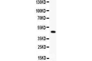 Anti- P2X5 Picoband antibody, Western blotting All lanes: Anti P2X5  at 0. (P2RX5 抗体  (AA 333-422))