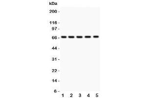 Western blot testing of HNF1A antibody and Lane 1:  rat liver (HNF1A 抗体  (AA 431-631))