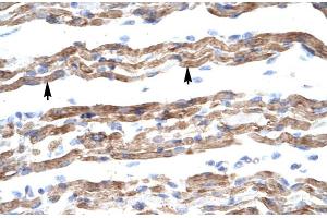 Human Muscle (PQBP1 抗体  (Middle Region))