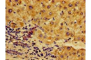 Immunohistochemistry of paraffin-embedded human liver tissue using ABIN7161777 at dilution of 1:100 (NFKB2 抗体  (AA 263-439))